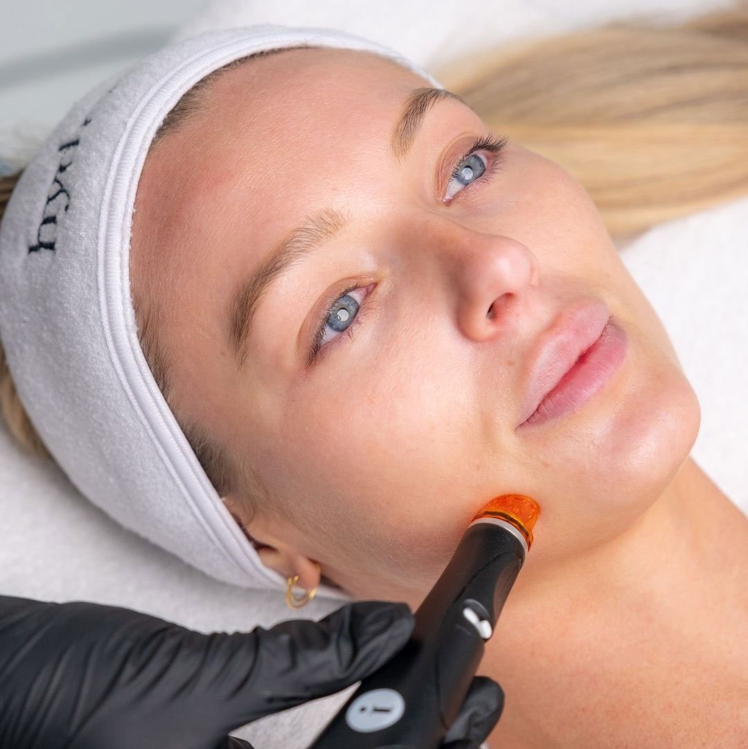 Closeup of woman with flawless skin recieiving a hydrafacial treatment
