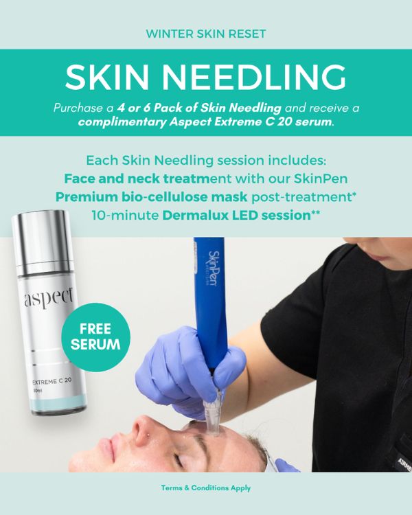 Skin Needling promotion details