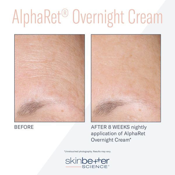 skin better science alphabet overnight cream before and after