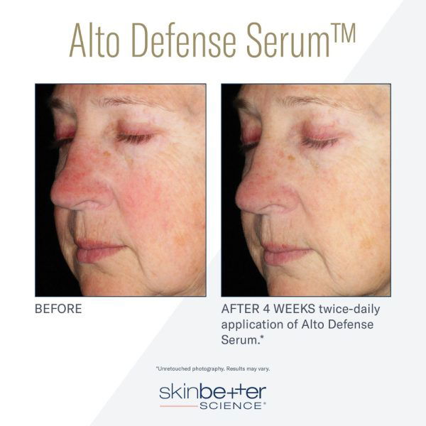 alto defense serum before and after